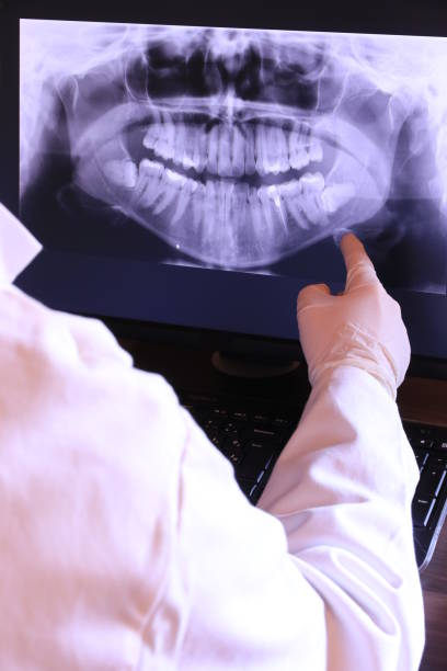 Best Broken or Chipped Tooth Repair in Poway, CA