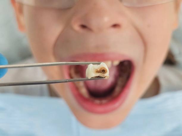 Best Emergency Pediatric Dental Care in Poway, CA
